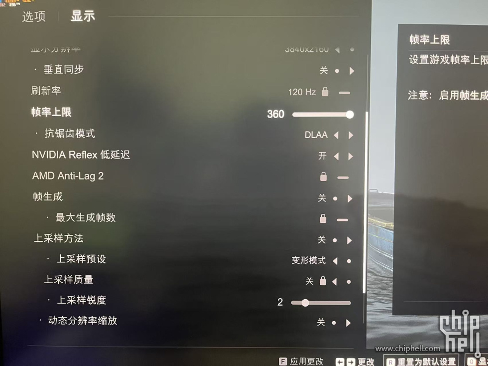 设置